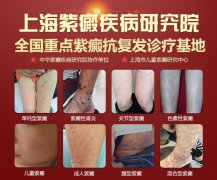 上海紫癜疾病研究院：过敏性紫癜引起的消化道出血如何更新?